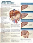 Understanding Liver Cancer Anatomical Chart 2nd Ed 2022